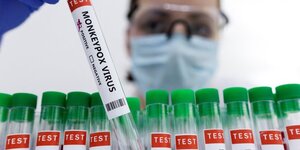 Plus de 1.000 cas de variole du singe signales a l'oms